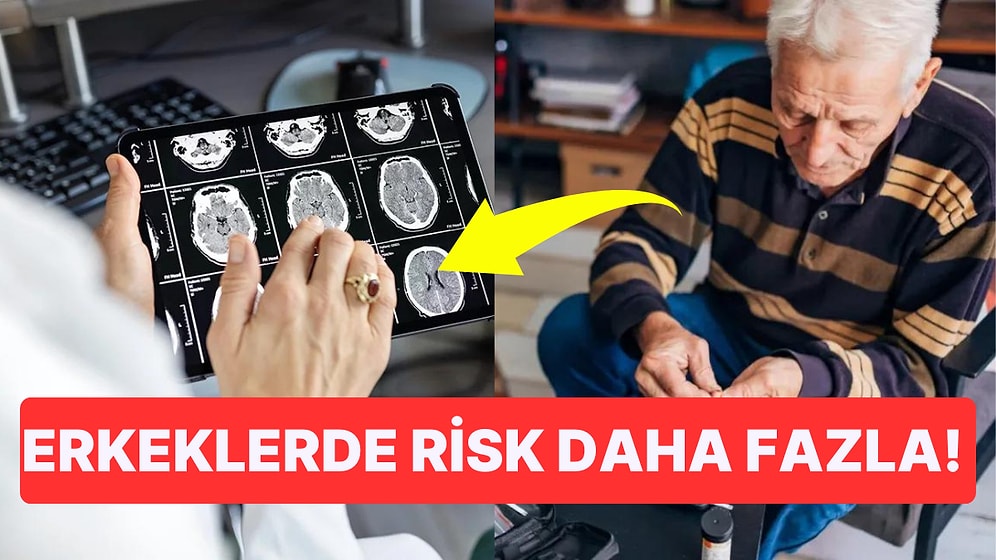 Son Araştırmalara Göre Zayıf Görünmesine Rağmen Yağ Oranı Yüksek Kişilerin Alzheimer Olma İhtimali Daha Yüksek