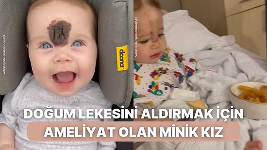 Alnındaki Doğum Lekesini Aldırmak İçin Ameliyat Olan Güzel Bebeğin Sürecine Siz de Şahit Olun