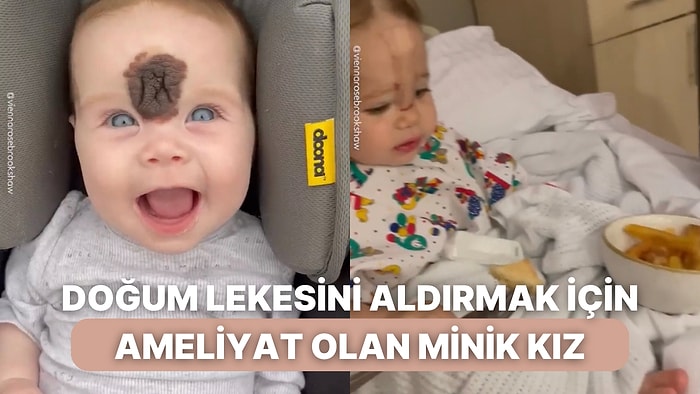 Alnındaki Doğum Lekesini Aldırmak İçin Ameliyat Olan Güzel Bebeğin Sürecine Siz de Şahit Olun