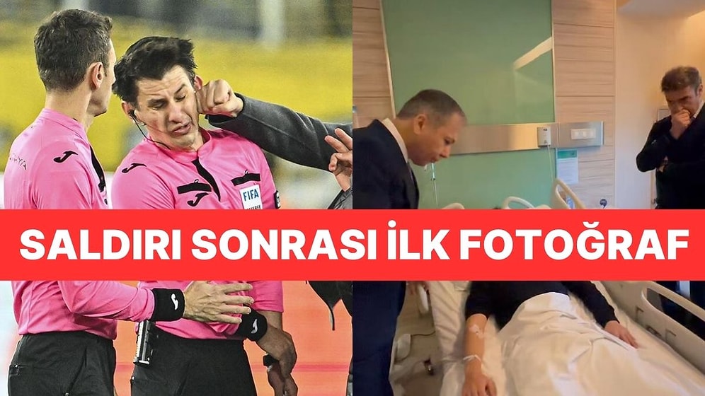 Cumhurbaşkanı Erdoğan, Yumruklu Saldırıya Uğrayan Hakem Halil Umut Meler İle Görüştü