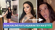 Estetik Kurbanı Olan Kısmetse Olur Yarışmacısı Simge Nur Erkoç Doktoruna Dava Açtı!