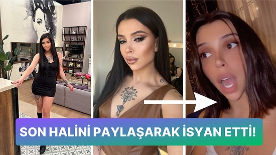 Estetik Kurbanı Olan Kısmetse Olur Yarışmacısı Simge Nur Erkoç Doktoruna Dava Açtı!