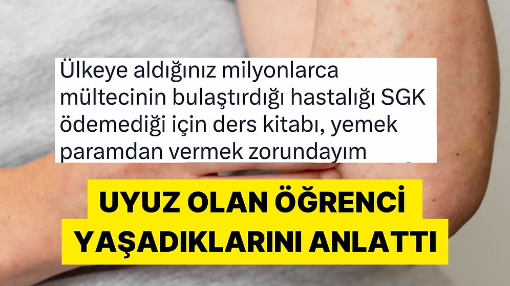 Sağlık Bakanlığı Yalanlamıştı! Uyuz Olduğunu İddia Eden Twitter Kullanıcısının İsyanı
