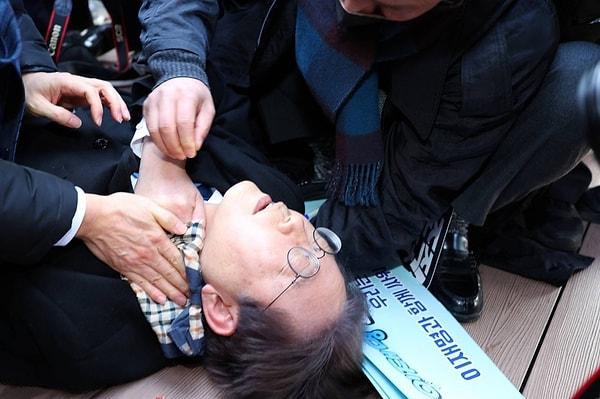 59 yaşındaki  Lee Jae-myung, Busan'ın Gadeok Adası'nda bir inşaat alanını ziyareti sırasında boynundan bıçaklandı.
