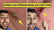 Göbek Deliğinin Tam Temizlenmediğinde Neler Olacağını Söyleyen Doktor Herkesin Midesini Ağzına Getirdi