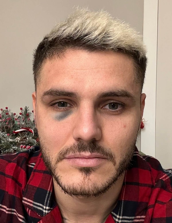 Mauro Icardi'nin Konyaspor, Sivasspor, Kayserispor, Trabzonspor karşılaşmalarında forma giyemeyecek.