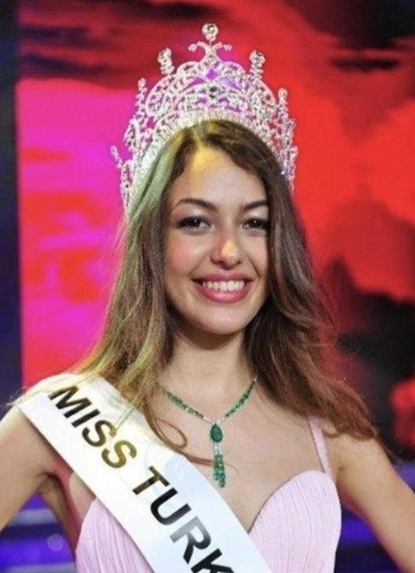 2014 yılında Elidor Miss Turkey yarışmasında ikinci olan ünlü oyuncunun yeni hali ile eski hali arasındaki dağlar kadar fark konuşulmayacak gibi de değil.