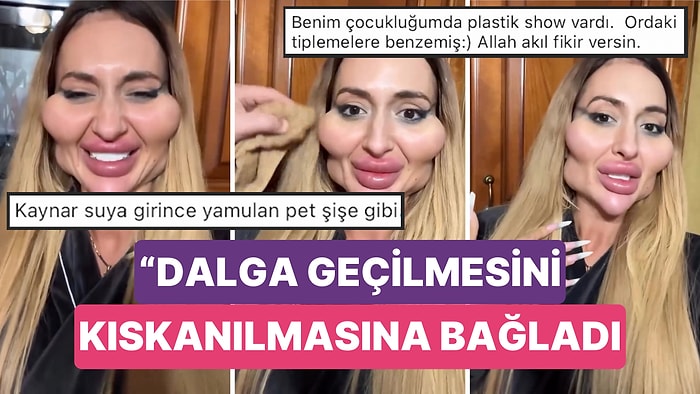 Estetikle Dünyanın En Büyük Elmacık Kemiklerine Sahip Olan Kadın Alay Konusu Olunca "Kıskanıldığını" Söyledi