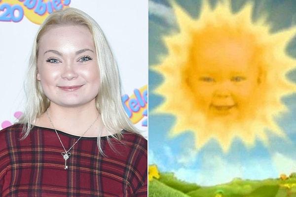 Doğar doğmaz bütün dünyanın tanıdığı güneş bebek Jess Smith, şimdi 28 yaşında.