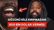 Mahallenin Delisi Kanye West, Bu Sefer De Bütün Dişlerini Çektirerek Titanyumla Kaplattı