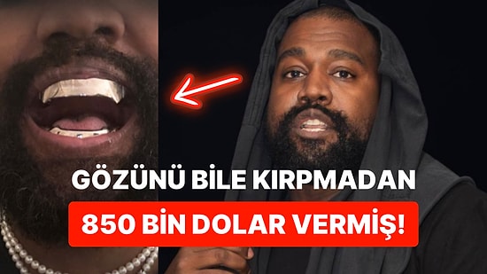 Mahallenin Delisi Kanye West, Bu Sefer De Bütün Dişlerini Çektirerek Titanyumla Kaplattı