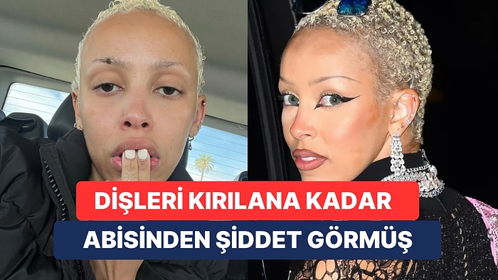 Abisi Tarafından Ağır Fiziksel ve Sözel Şiddet Gören Doja Cat'in Annesi Sessizliğini Bozdu ve Şikayetçi Oldu