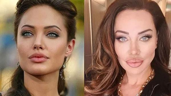Sayısını unuttuğumuz estetik operasyonların ardından Angelina Jolie'nin ikizi hâline gelen Akyürek bu değişimlerini de sosyal medya hesabından paylaşıyor.