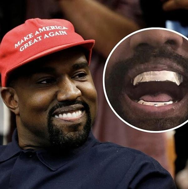 16. Kanye West'in eşi Bianca Censori'nin kocasının olay yaratan yeni titanyum dişlerini ekran resmi yaptığı objektiflere yakalandı.