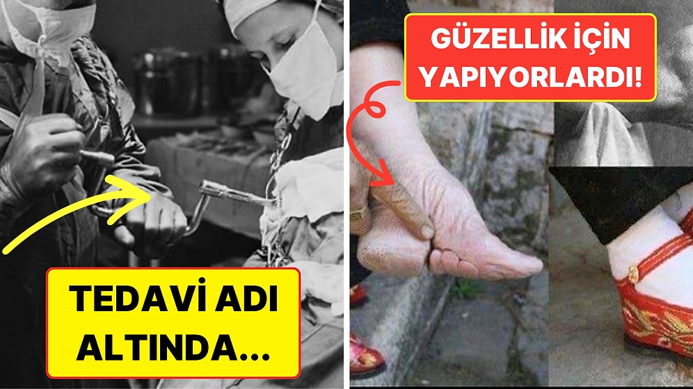 Kaş Yapayım Derken Göz Çıkartan Hareketleriyle Hepimizi Şok İçerisinde Bırakmış 15 Kişi