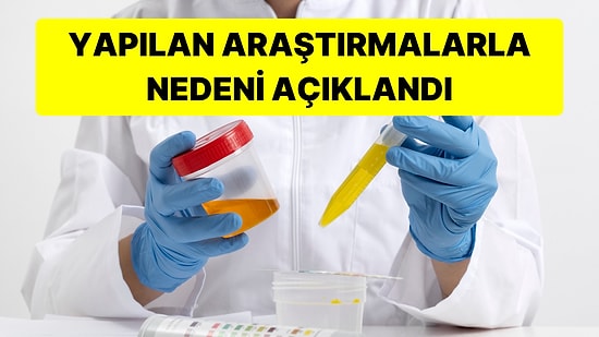 Hep Merak Etmiştik! Tuvalete Çıktığımızda İdrarımız Neden Sarı Renkte Olur?