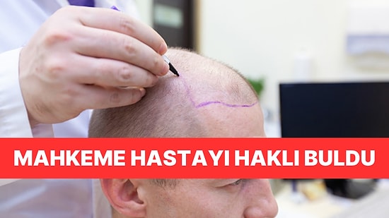 Saç Ekimi Başarısız Olunca Dava Açtı: Mahkeme "Ayıplı İşlem" Olarak Kabul Etti