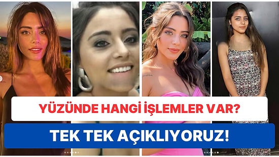 Kızılcık Şerbeti'nin Doğa'sı Sıla Türkoğlu'nun Yüzüne Yaptırdığı Estetikleri Tek Tek Açıklıyoruz!