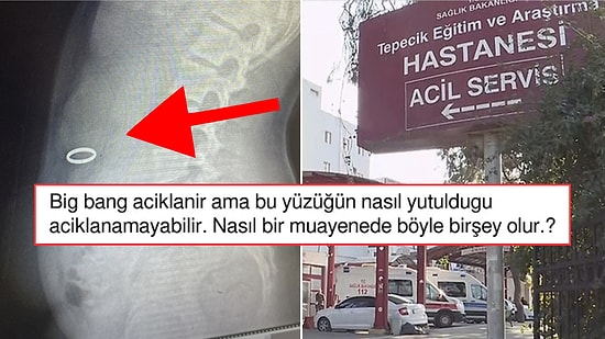 Nasıl Yani?! Hasta Muayene Sırasında Doktorun Parmağındaki Yüzüğü Yuttu!