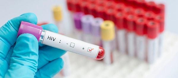Türkiye'de geçen yılın verilerine göre HIV ile yaşayan 35 bin 807 kişi var.