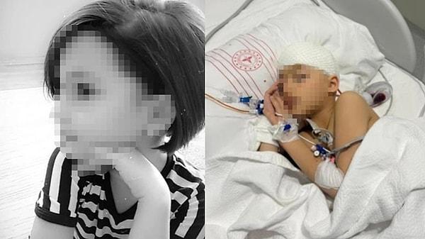 Ankara'daki bir okulda öğrenim gören 8 yaşındaki Mira Şahin'in düşme sonucu beyin kanaması geçirdiği iddia edildi. Şahin'in kafatasında 8 kırık olduğu öğrenilirken, yoğun bakımda tedaviye alındı.