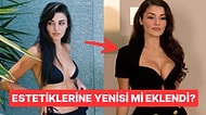 Estetiklerine Bir Yenisi Eklendi: Hande Erçel'in Eski Hali Meme İmplantını Akıllara Getirdi