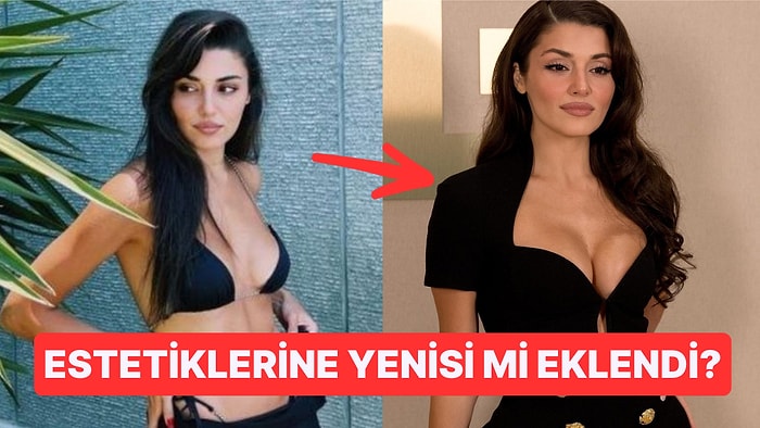 Estetiklerine Bir Yenisi Eklendi: Hande Erçel'in Eski Hali Meme İmplantını Akıllara Getirdi