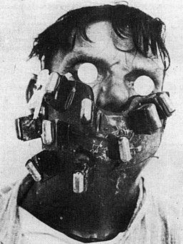 9. 1924'te İngiltere'de yüz ve boyunundaki kanseri tedavi etmek için tasarlanmış özel bir maske giyen adam.
