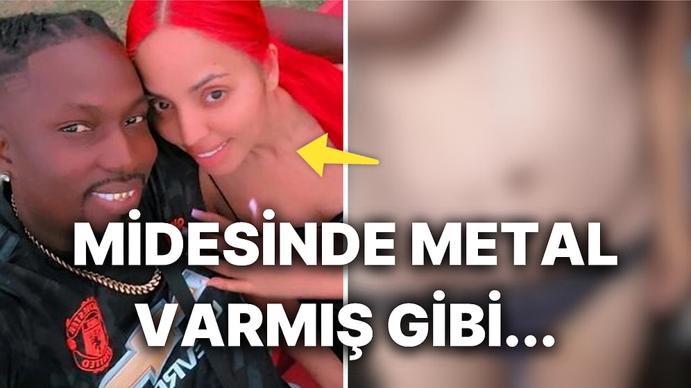 Estetik Yaptırmak İçin Evlerini Satıp Türkiye'ye Gelen Çiftin Hayatı Cehenneme Döndü