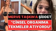 Merve Taşkın Sevgilisinden Gördüğü Şiddeti Paylaştı: "Cinsel Organıma Tekmeler Atıyordu"