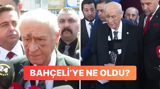 Oyunu Kullanan Devlet Bahçeli'nin Yüzündeki Morluklar ve Sargılı Kolu Dikkat Çekti