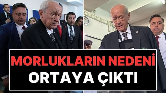 Devlet Bahçeli'nin Yüzündeki Morlukların Sırrı Ortaya Çıktı: Ünlü Gazeteci Kazanın Nedenini Yazdı