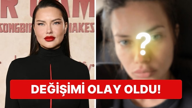 Son Çare Estetiğe mi Başvurdu? Doğum Sonrası Kilolarıyla Gündemde Olan Adriana Lima'nın Değişimi Şoke Etti