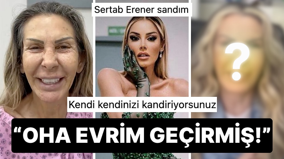 Estetik Furyasına Sürüklenip Ameliyatlı Fotoğrafıyla Korkutan Petek Dinçöz'ün Annesinin Son Hali Şoke Etti!
