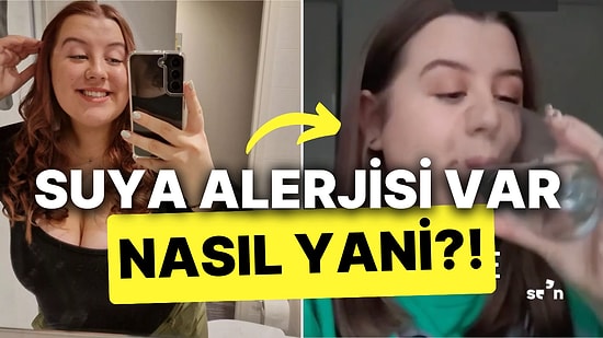 Suya Alerjisi Olan Kadın En Çok Merak Edilen Soruları Yanıtladı