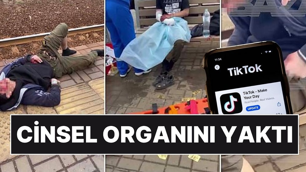 TikTok Akımı Facia İle Bitti: 15 Yaşındaki Çocuk Cinsel Organını Yaktı!