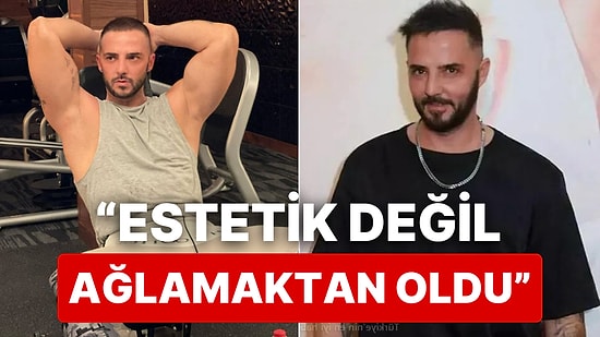 Israrla Dolgu ve Botoks Yaptırmadığını Söyleyen Gökhan Özen'in Son Estetik Açıklaması Yürek Burktu!