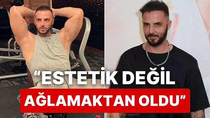 Israrla Dolgu ve Botoks Yaptırmadığını Söyleyen Gökhan Özen'in Son Estetik Açıklaması Yürek Burktu!