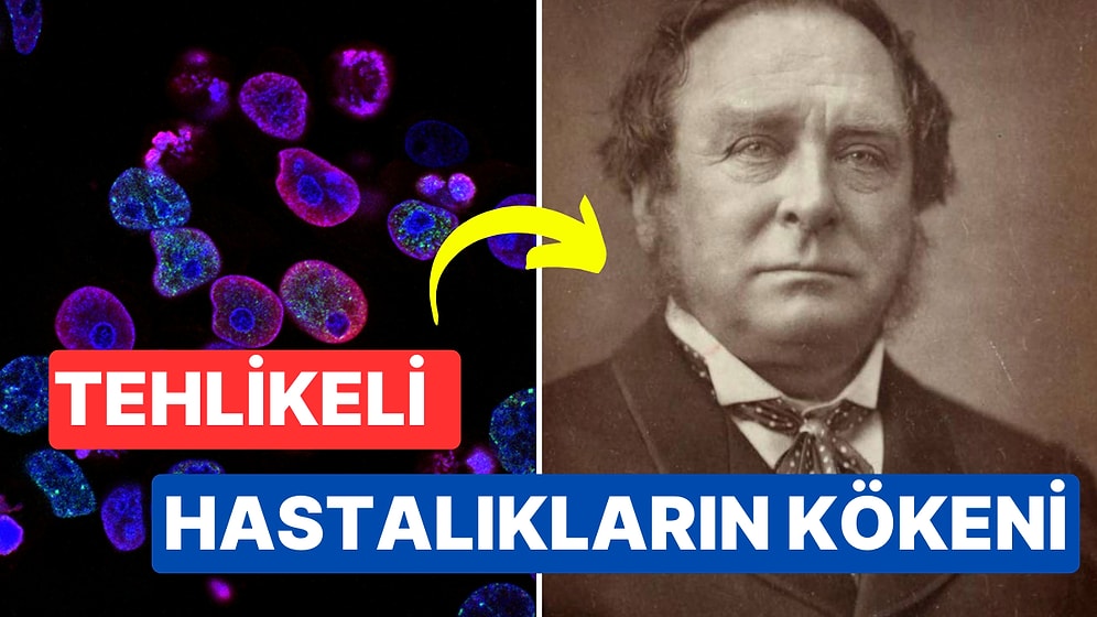 İsimlerini Dünyaca Ünlü Bilim İnsanlarından Alan 13 Ciddi Hastalık