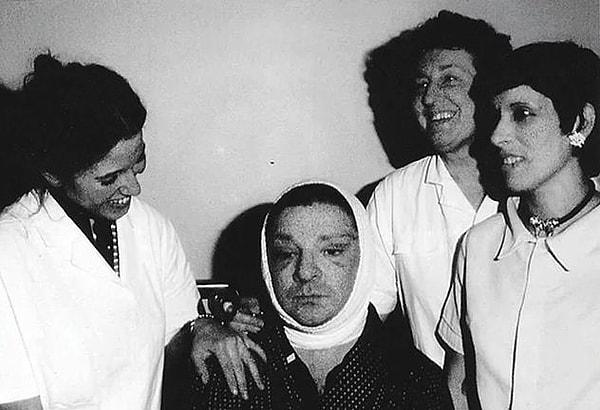 Çünkü yüzündeki bazı noktalar gözüne batmış ve 1980 yılında estetik ameliyat olmak için Paris'in yolunu tutmuş. Ameliyatı dünyaca ünlü yıldızlar Elizabeth Taylor ve Sophia Loren’in operasyonlarını da yapan Dr. Rudolphe Troque gerçekleştirmiş.