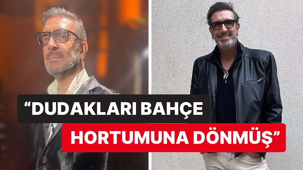 Cem Özer Estetik Yaptıran Oyunculara Ağır Göndermelerde Bulundu "Herkes Birbirine Benziyor" Yorumu Olay Oldu