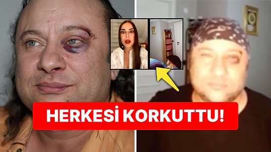 Kadir Doğulu ve Tarikat Adı Geçmişti: Darp Edilen Onur Akay Canlı Yayında Bayıldı!