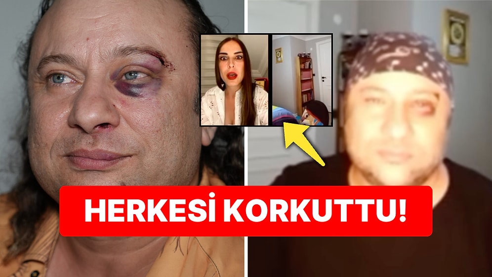 Kadir Doğulu ve Tarikat Adı Geçmişti: Darp Edilen Onur Akay Canlı Yayında Bayıldı!