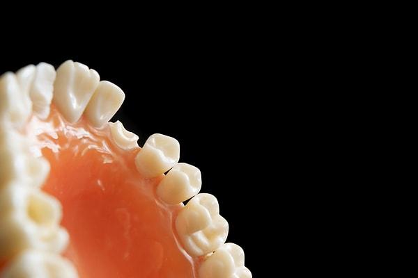 Kyoto Üniversitesi Hastanesi, Eylül 2024'te dişleri yenileyebilen bir ilacın dünyadaki ilk insan denemesine başlayacak.