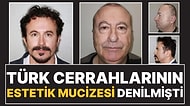 Estetik Mucizesi Diye Paylaşılan Adam Türk Çıktı: "Kafa Nakli Yaptırmadım"