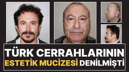 Estetik Mucizesi Diye Paylaşılan Adam Türk Çıktı: "Kafa Nakli Yaptırmadım"