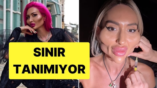 Dünyanın En Büyük Elmacık Kemiklerine Sahip Modeli Yeni Bir Estetik Operasyon Daha Geçirdi