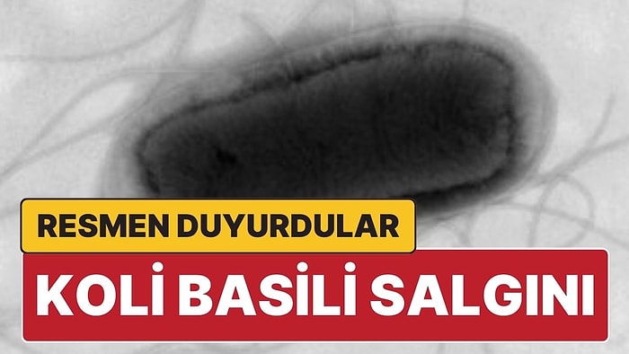 İngiltere 'Koli Basili' Salgını Olduğunu Duyurdu: 113 Kişi Karantinaya Alındı