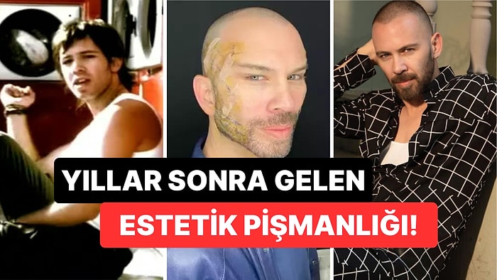 Yaptırdığı Fransız Askısı Operasyonundan Sonra Bambaşka Birine Dönüşen Berksan'dan Yıllar Sonra Gelen İtiraf!