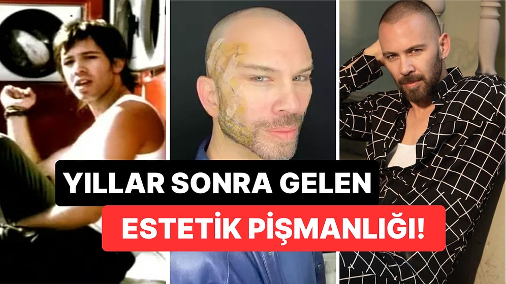 Yaptırdığı Fransız Askısı Operasyonundan Sonra Bambaşka Birine Dönüşen Berksan'dan Yıllar Sonra Gelen İtiraf!